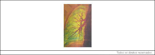 capilares pulmonares